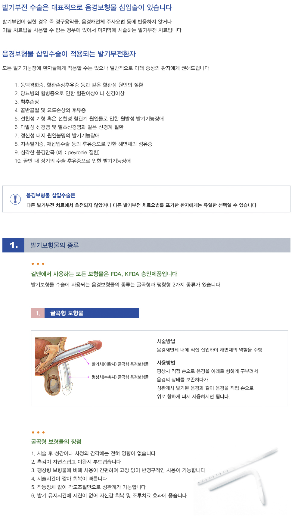 발기보형물 수술