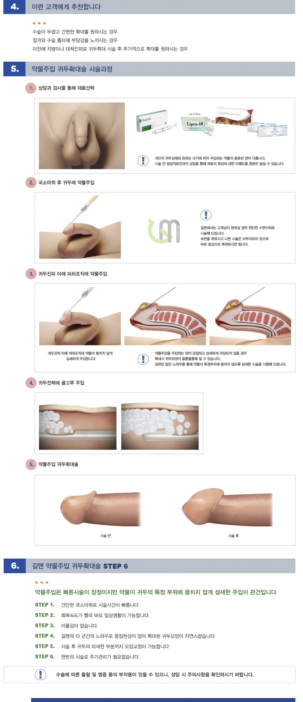 울트라팻 귀두확대