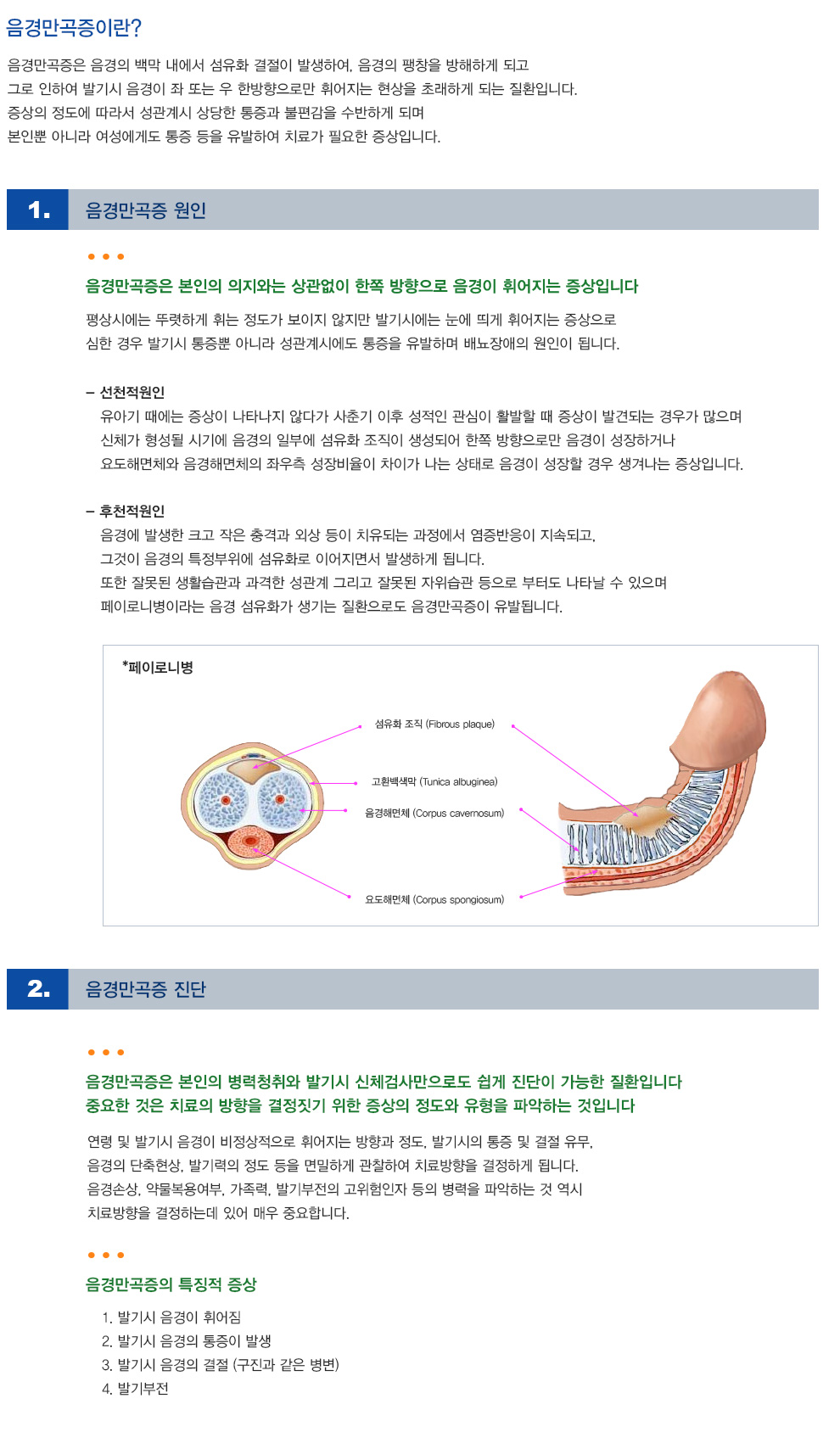 음경만곡증